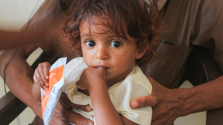 Enfant suivi dans un programme de nutrition au Yémen lié au Programme alimentaire mondial.